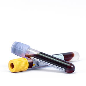 how much bac water for semaglutide How to Mix Semaglutide With Bacteriostatic Water (Step-by-Step, MD PhD  Guide)  casa de sante